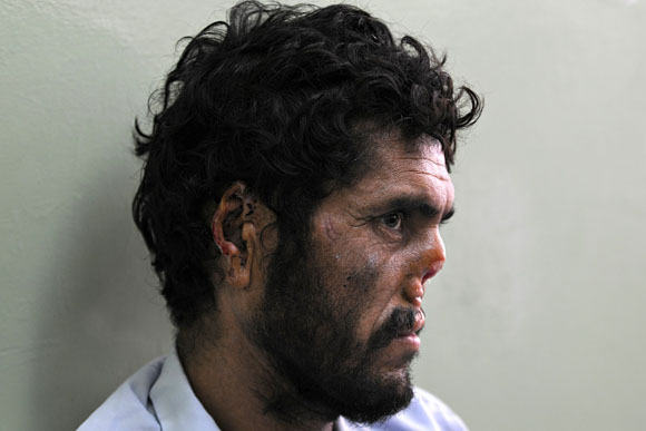 Forrás: AFP/Maszúd Husszein Forrás: AFP/Maszúd Husszein
