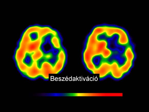 Forr�s: dr. Borb�ly Katalin, Orsz�gos Onkol�giai Int�zet